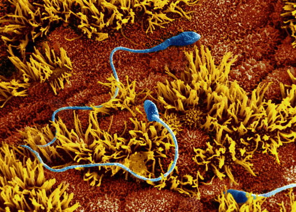 Сперматозоиды продвигаются к яйцеклетке со скоростью 2 — 3 мм в минуту, постоянным волнообразным сокращениям. Фото: Dr. David Phillips/Getty Images