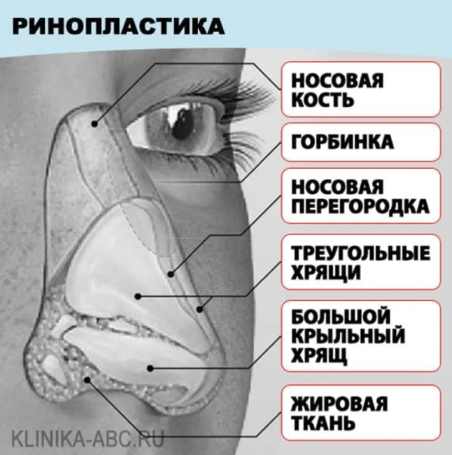 ринопластика кончика носа