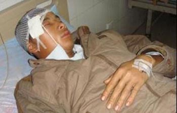 Крестьянин, раненый в результате столкновения с полицией. Фото: boxun.com