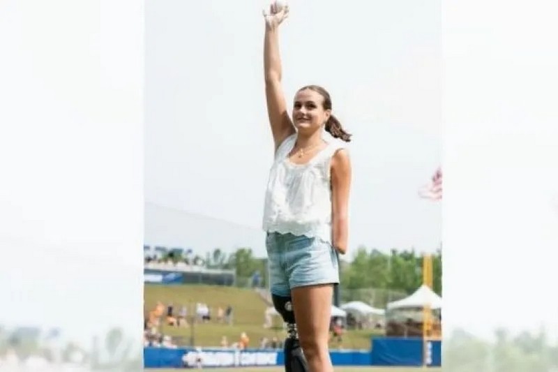 Посміхаючись і виявляючи рішучість, 17-річна Лулу Гріббін уособлює силу та стійкість після нападу акули, який кардинально змінив її життя. (capture écran Instagram Lulu Gribbin)