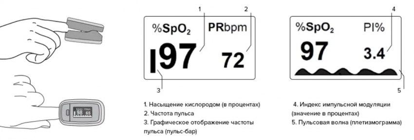 схема работы