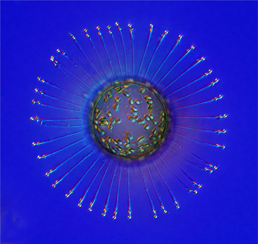 Діатомова водорість з моря Амундсена (Антарктида). Розмір кульки, з якого виступають нитки, складає всього 40 мікрон. Фото: John Dolan/Villefranche-sur-Mer, France 