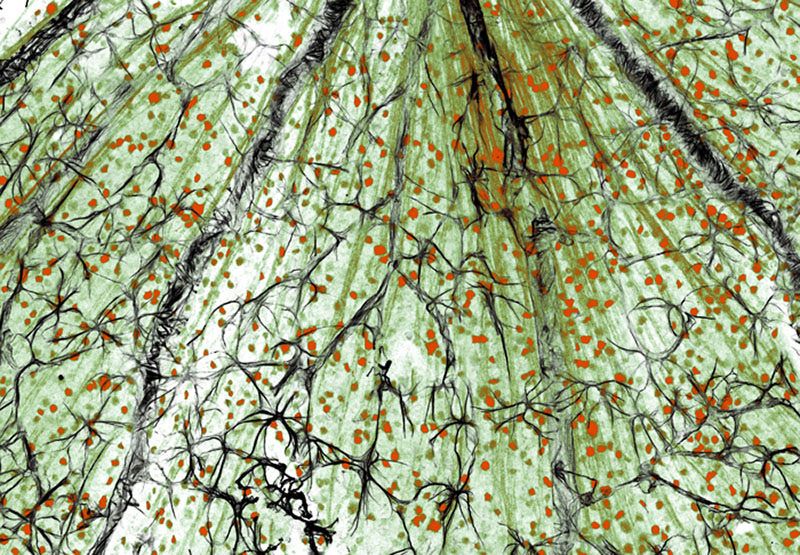 Мережа астроцитів (чорний колір) на поверхні сітківки ока миші. Ці клітини контролюють кровоток, а також забезпечують роботу нейронів (помаранчевий колір) і аксонів (зелений колір). Фото: Alejandra Bosco, Monica Vetter/University of Utah, USA 