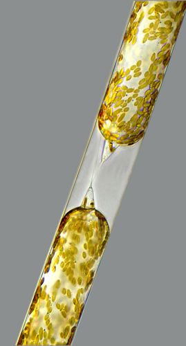 Діатомова водорість «Rhizosolenia setigera» безпосередньо після ділення. Зразок взятий неподалік від архіпелагу Гельголанд в Північному морі. Фото: Wolfgang Bettighofer/Kiel, Germany 