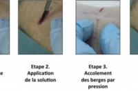 Фото: CNRS/ESPCI Paris Tech