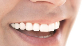Современные методы стоматологического протезирования