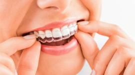 Елайнери «Інвізілайн»: інноваційне рішення для виправлення прикусу та вирівнювання зубів