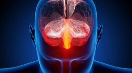 Дивовижні факти і явища: Незвичайні розлади мозку