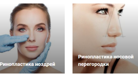 Особенности и преимущества пластической хирургии
