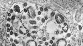 CDC попереджає про спалахи смертельного вірусу Марбург в Африці (ВІДЕО)