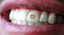  Крошечный датчик, прикреплённый к зубу, сможет отправлять информацию о здоровье