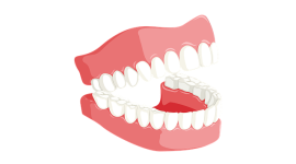 Як заощадити на імплантації зубів