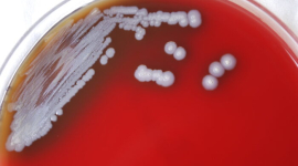 Бактерії, що викликають рідкісне тропічне захворювання, виявлені в ґрунті США