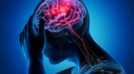 У людей, страдающих мигренью, есть другие варианты, кроме обезболивающих – говорит доцент кафедры неврологии