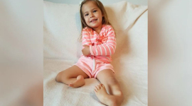 Дівчинка, яка народилася з ногами, вивернутими назад, після операції знову ходить (ФОТО)