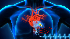 Нові кардіостимулятори не потребуватимуть зарядки