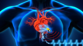Суперконденсатор, не требующий зарядки, — новое поколение батарей для кардиостимуляторов