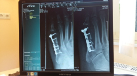 Рентгенівські апарати: минуле, сьогодення і майбутнє медичної діагностики