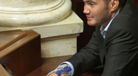Віктор Янукович-молодший зламав руку