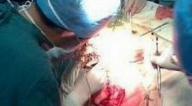 Китайские хирурги по ошибке прооперировали не ту ногу пациента