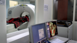Новое исследование: компьютерная томография и ангиография могут вызвать заболевания щитовидной железы