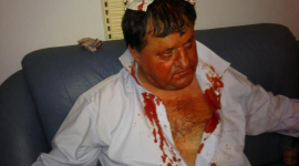 «Регионалы» разбили голову депутату от оппозиции