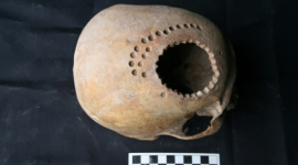 Трепанація черепа у давній Америці: як вона проводилась?