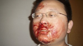 Незалежного депутата Сунь Буар побив співробітник Відділу державної безпеки Китаю