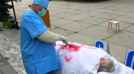 Охоронець двічі виявився свідком вилучення органів у живих людей