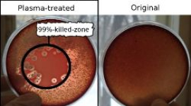 Терапия с помощью холодной плазмы может стать альтернативой применению антибиотиков