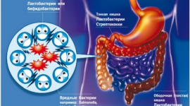 Як оздоровити кишечник без ліків