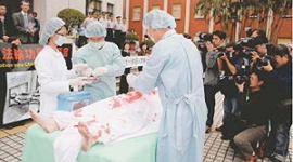 Готується нова ухвала, що забороняє видаляти органи у неповнолітніх в Китаї