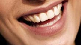 Голлівудська посмішка - здорові зуби?