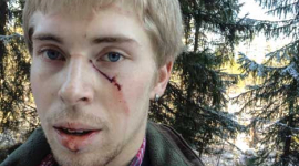 Ведмідь напав на шведського хокеїста: чоловік вижив
