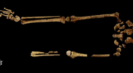 Виявлено найбільш ранній відомий випадок хірургічної ампутації кінцівки: 31 000 років тому