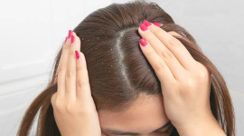 Персональное решение для здоровых волос: как выбрать и использовать шампунь от перхоти
