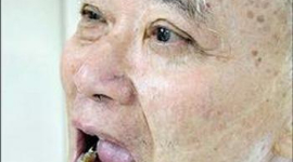 Более 97% китайцев страдают болезнями рта 