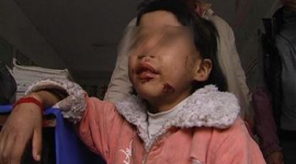 Строгие китайские родители раскалёнными щипцами воспитывали свою 6-летнюю дочку