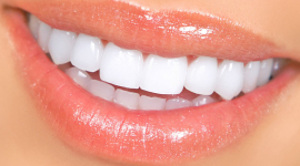 Виниры: долгий путь средства №1 в художественной реставрации зубов 