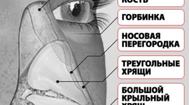Горбинка на носу: откуда она берётся и можно ли от неё избавиться?