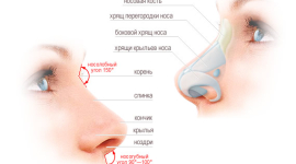 Ринопластика - возможность изменить свою жизнь к лучшему редакция 
