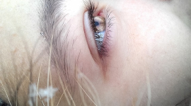Глаукому помогут вылечить глазные капли на основе куркумы — исследование