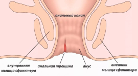 Анальная трещина: причины, симптомы, лечение 