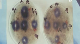 У Румунії виявлено два випадки малярії у масажисток — перші за 40 років (ВІДЕО)