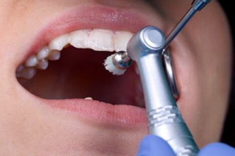 Премиумные зуботехнические материалы: роскошь или необходимость?