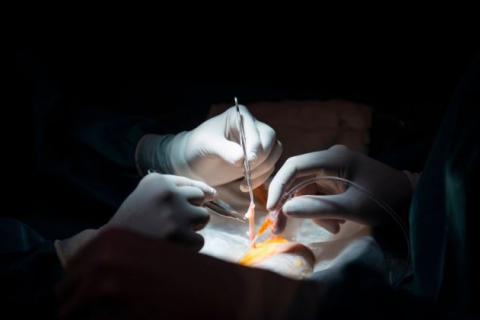 Хирурги как "палачи": Китайские врачи совершают убийства для поддержки индустрии трансплантации органов, результаты исследования
