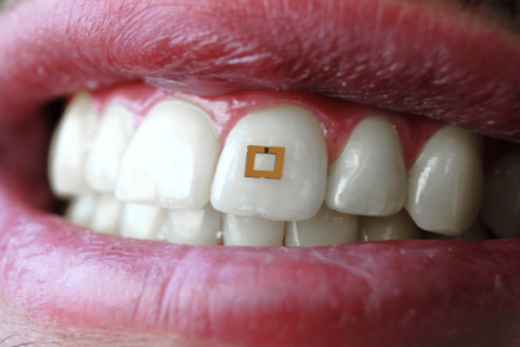  Крошечный датчик, прикреплённый к зубу, сможет отправлять информацию о здоровье