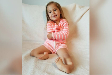 Девочка, которая родилась с ногами, вывернутыми назад, после операции снова ходит и мечтает стать гимнасткой