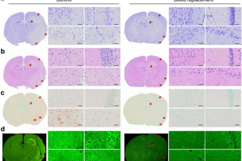 Переливання крові врятувало мишей від наслідків інсульту, — дослідження