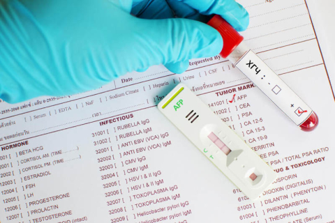 Что такое анализ крови на ХГЧ и как к нему подготовиться